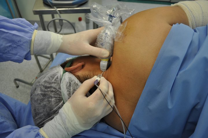 OTSZ Online - Műtéti alatti vérnyomásszabályozás